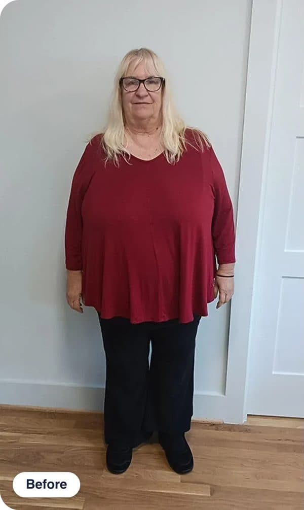 Danielle R. before treatment