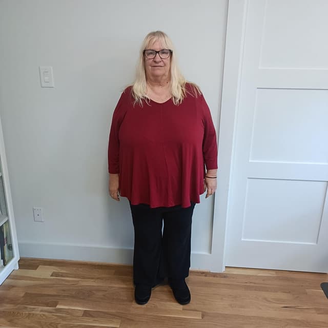 Dawn M. before treatment